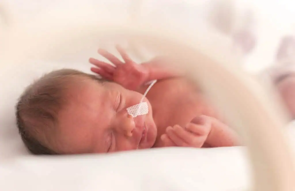 a premature baby changes everything