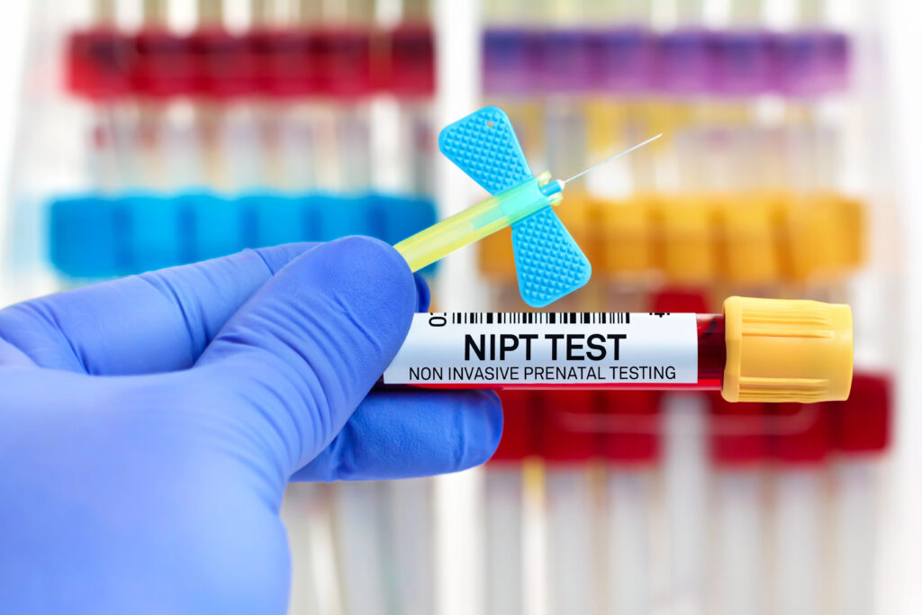 Invasive Testing Routine Tests Performed During Pregnancy And Why They Are Used
