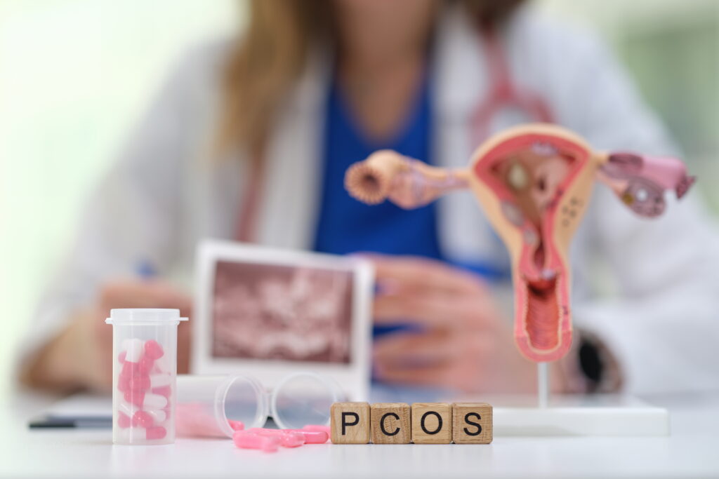 PCOS In Teens - Information