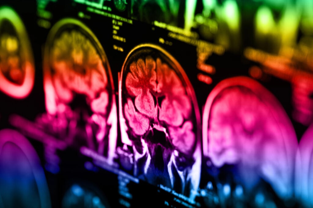 brain imaging