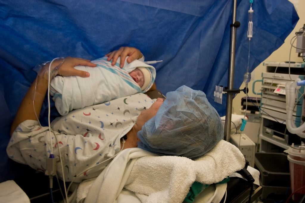 A woman holding her newborn after having a C-section birth